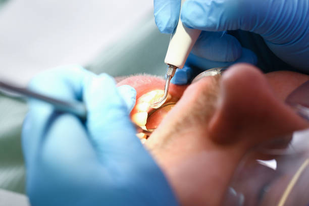 Best Emergency Tooth Extraction in Nashville, IN