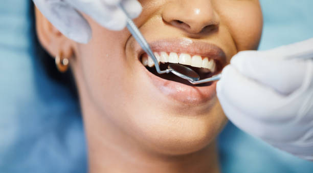 Best Emergency Broken Tooth Repair in Nashville, IN
