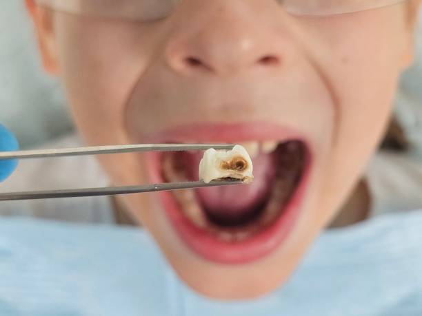 Best Emergency Dental Care for Trauma or Injury in Nashville, IN
